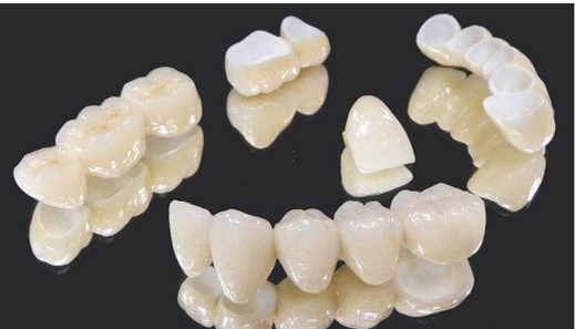 全瓷牙的报价是多少?在材料上有什么优势?修复时怎样选择医院?
