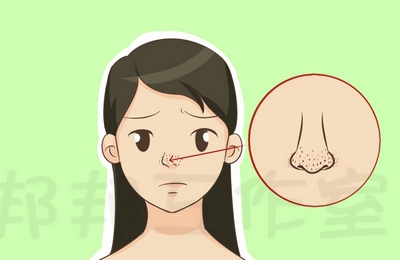 黑头怎么去掉?学会这五种简单有果的方法,黑头粉刺通通远离!