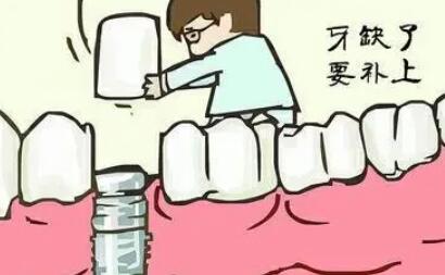 青海省人民医院口腔科怎么样？真人牙齿种植案例分享：公布恢复过程！