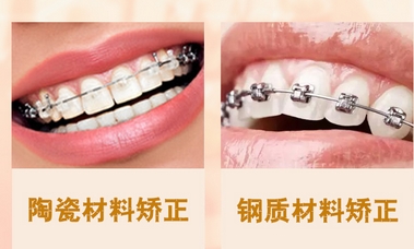 广州矫正牙齿多少钱?牙齿矫正有哪些方法?及时矫正,受益终生!