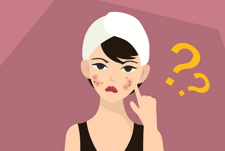 如何去痘痘疤痕？告诉你两个正确去除疤痕的好方法！注意事项有哪些？