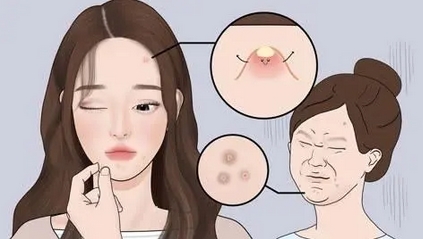 如何去痘痘疤痕？告诉你两个正确去除疤痕的好方法！注意事项有哪些？
