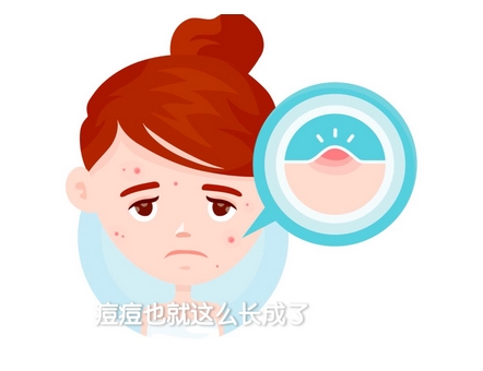 如何去痘痘疤痕？告诉你两个正确去除疤痕的好方法！注意事项有哪些？