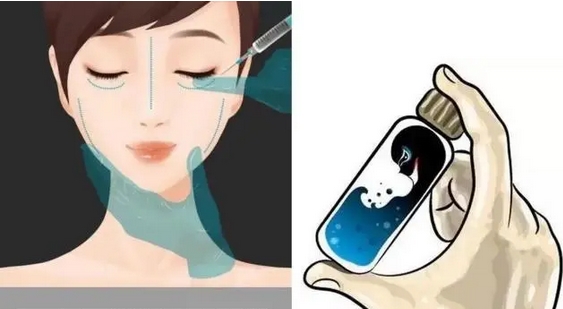 玻尿酸填充泪沟好不好？价格是多少？术前和术后注意事项有哪些？灵动大眼get~