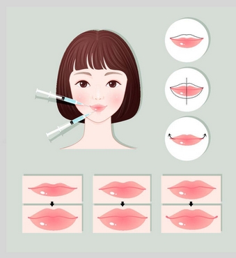 广州广美徐立志怎么样?徐立志医生口碑实力如何?整形果显著~