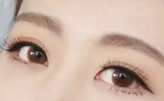 上海九院张路双眼皮怎么样？优选几位口碑专家实力上榜！技术水平详情告知~