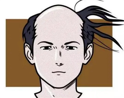 种头发价格是怎样算的?种头发价格受哪些因素影响?