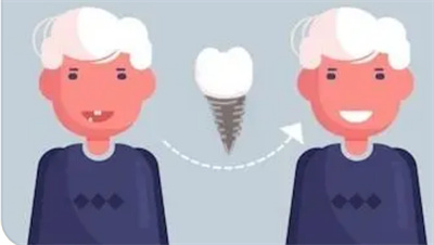 牙种植后注意事项有哪些？牙种植后术后怎么保养？