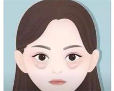 怎样有效去眼袋？正确的护理方法有哪些？速速看！