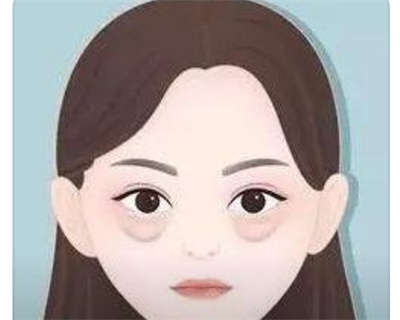 怎么样去眼袋？如何护理自己的眼部？速速查看！