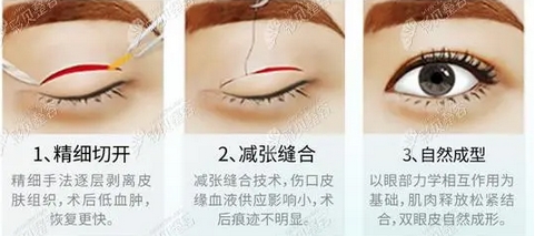西南医院美容美容整形科双眼皮价格更新!重庆"网红"整形医生技术测评!附价格表~