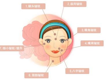 眼尾纹除皱方法有哪些？注意事项有哪些？多久可以见效呢？