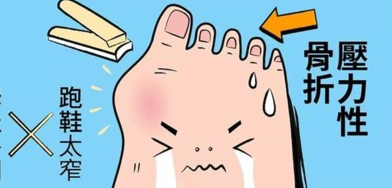 大脚骨怎么办?有什么调节方法?戳进来了解一下