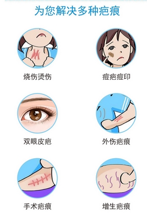 成都欣奕除疤怎么样?会不会达到理想果?除疤医生信息|综合实力简介~