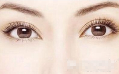 西安市中心医院整形外科双眼皮怎么样?医生简介-双眼皮真实案例参考!