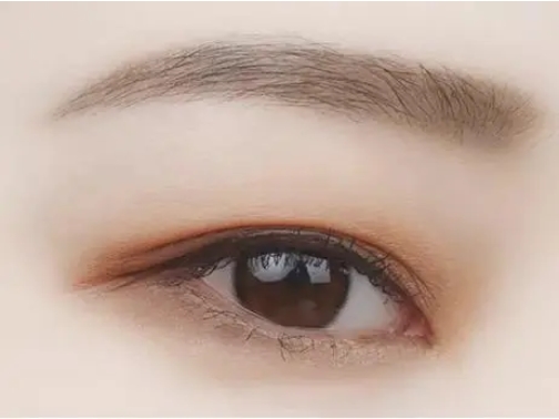 单眼皮如何变双眼皮?做完双眼皮之后注意事项有哪些?附详细资料分享~