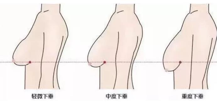 杭州格莱美整形怎么样？院内医生的实力如何？从网友的评论中看看吧！