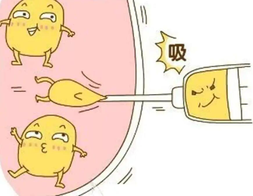 手臂吸脂要q麻吗？原理及注意事项在线一览！不要错过