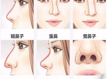 汕头伊丽莎白整形医院如何?医生怎么样?走近热门项目介绍/医生分享~
