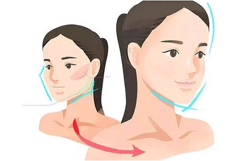 整瓜子脸需要多少钱?整瓜子脸是什么原理?提升魅力值~