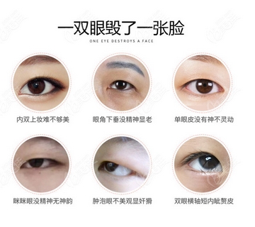 咸阳二院美容科双眼皮如何?医生资料简介|科室信息~看看真实案例如何吧!