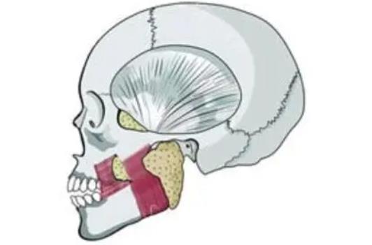 去颊脂垫多久能恢复？有什么优势？术后如何护理呢？