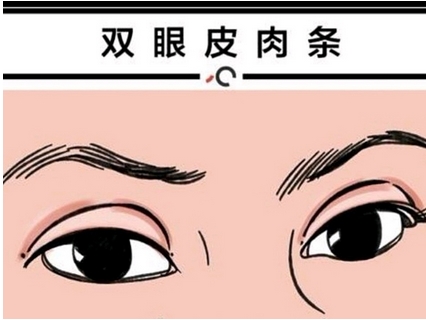 崔永言修复双眼皮案例如何?医生个人信息及口碑如何?修复实力评价!