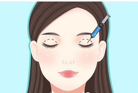 崔永言修复双眼皮案例如何?医生个人信息及口碑如何?修复实力评价!