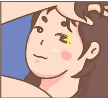 刚做了双眼皮手术的照片是什么?真实案例分享全记录!肿泡眼姐妹一定要看看~