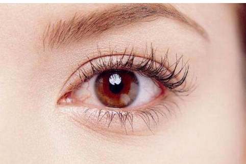 刚做了双眼皮手术的照片是什么?真实案例分享全记录!肿泡眼姐妹一定要看看~