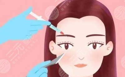 刚做了双眼皮手术的照片是什么?真实案例分享全记录!肿泡眼姐妹一定要看看~