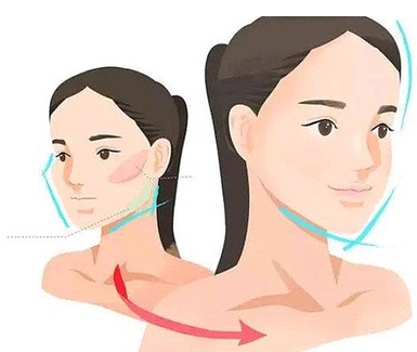 女人过大下颌角整形如何?价格贵不贵?看看费用与哪些因素有关呢?