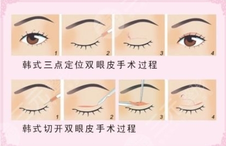 李天石双眼皮手术如何?专家详细坐诊信息,做手术很有一手!