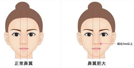 戴传昌做的鼻子案例如何?医生详细信息|手术风格偏向如何?做鼻子评价更新~