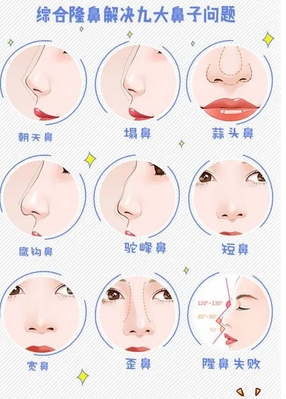 北京丹熙张正韬做鼻子案例是什么？医生从业履历、技术优势！隆鼻医生种草测评~