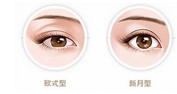 青岛伊美尔双眼皮如何？靓眼攻略细说案例的那些事！附科室介绍~