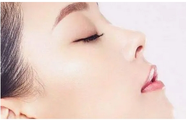 膨体隆鼻恢复时间如何？是什么原理呢？优势和弊端清楚了解很关键！