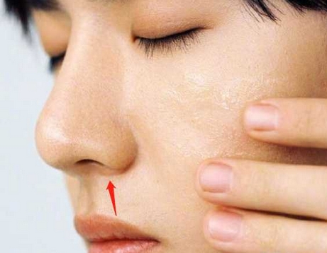 鼻翼缩小的方法是什么？手术原理、注意事项一览！如何护理术后状态？