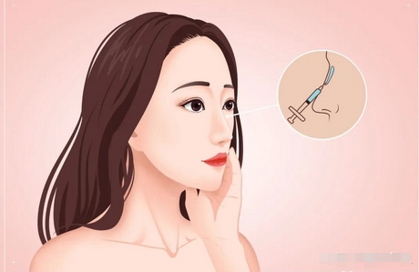 李劲良做鼻子好吗？擅长什么风格？真人隆鼻案例果参考~
