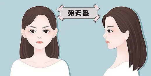 李劲良做鼻子好吗？擅长什么风格？真人隆鼻案例果参考~