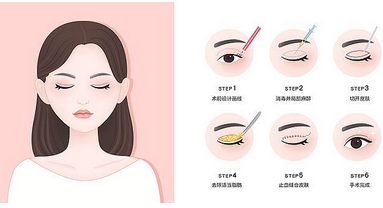 杭州张霞飞双眼皮案例怎么样？医生坐诊排班资料，做手术很有一手哦！
