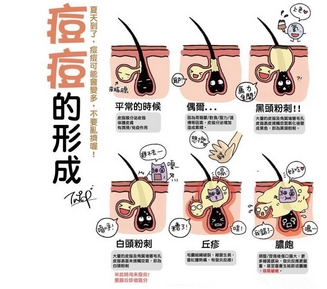 中山大学附属六院美容科调节青春痘价格如何？医院人气项目|祛痘临床反馈!口碑荣誉参考~