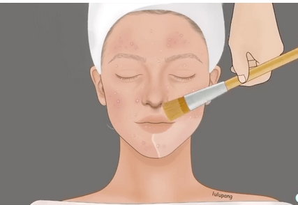 中山一院整形修复科激光去痘疤多少钱?各种陈年旧疤不是问题!科室案例介绍~