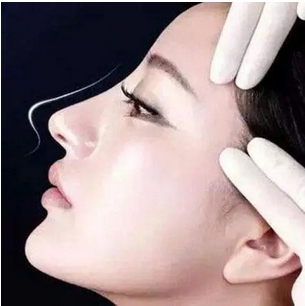 陈辉医生个人工作室怎么样？隆鼻恢复时间多久？整形专家告诉你怎么护理！