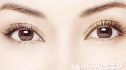 总医院李先慧双眼皮怎么样？防止疤痕增生该怎样做？快来看看案例过程吧！