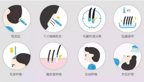 医学科学院整形医院植发怎么样？医生技术实力介绍-案例公开，等你来品鉴！！