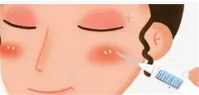 深圳北大医院何君君怎么样？自体脂肪填充面部案例揭秘
