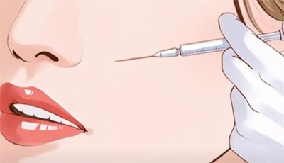深圳北大医院何君君怎么样？自体脂肪填充面部案例揭秘