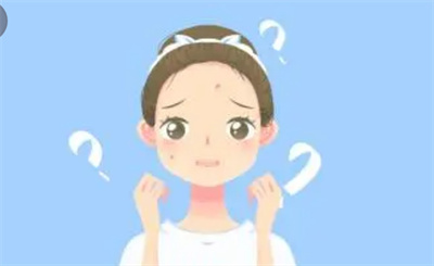 激光祛痘怎么收费?术后注意事项有哪些?案例分享!