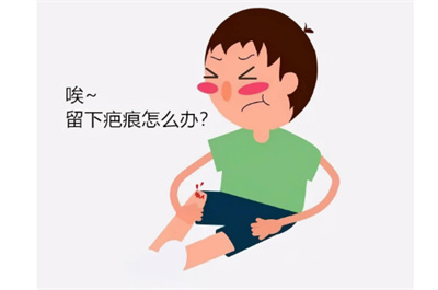 四川友谊医院疤痕科怎么样？医生有哪些？激光祛疤案例分享